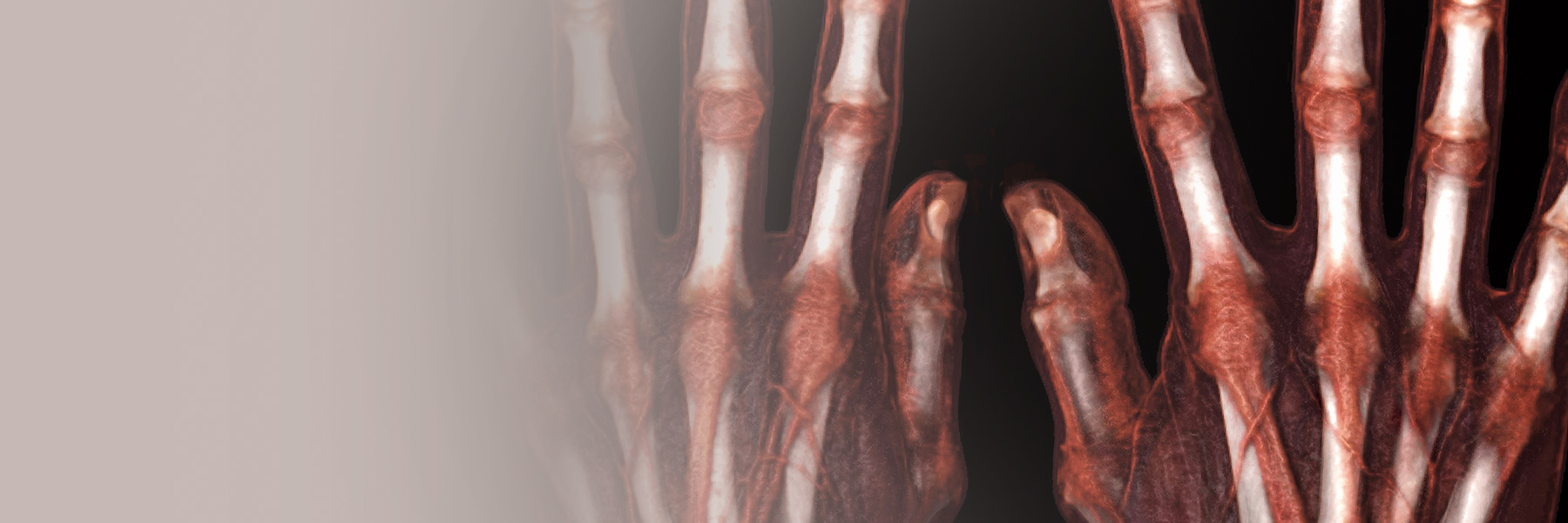 Musculoskeletal Imaging